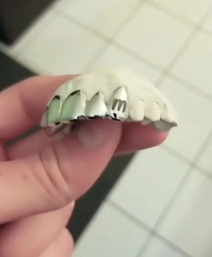 Gravure sur dents en métal